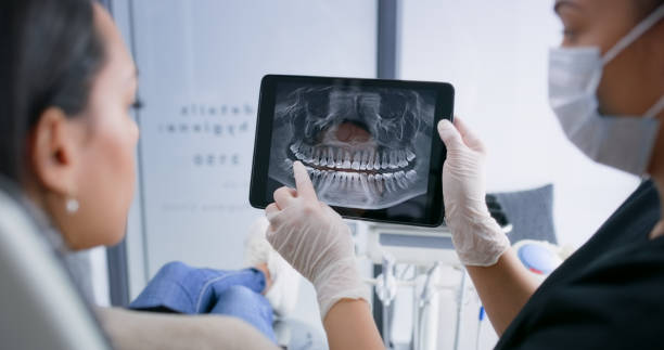 Licensed Teeth Whitening service in St. Martinville, LA - Smile Center Dentistry